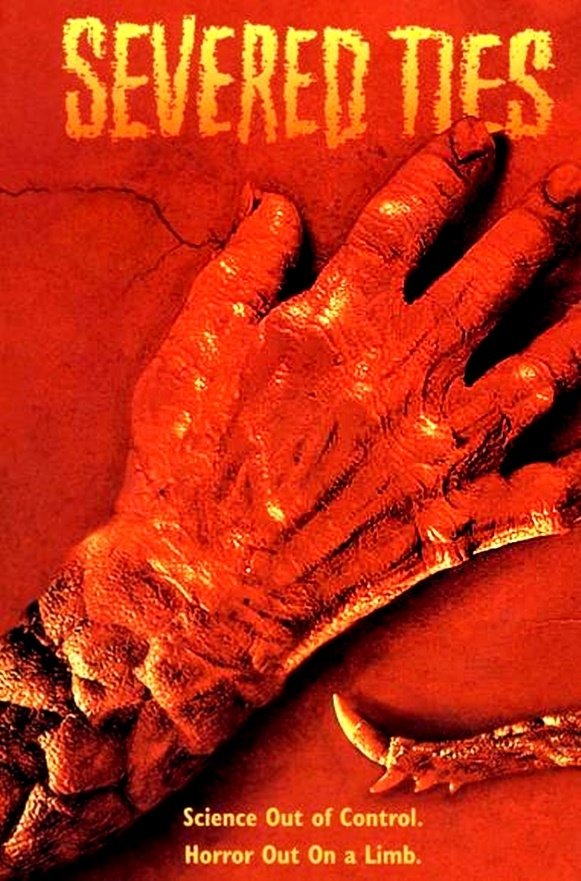 Постер Severed Ties